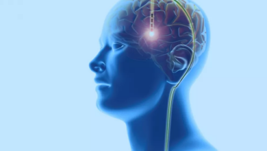 تجربة طبية رائدة لعلاج الإدمان باستخدام التحفيز العميق للدماغ